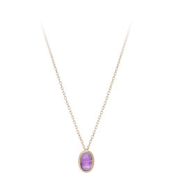 アクセサリー Masa Amazon.co.jp: キジマ(Kijima) バイクパーツ ステー ハンドル